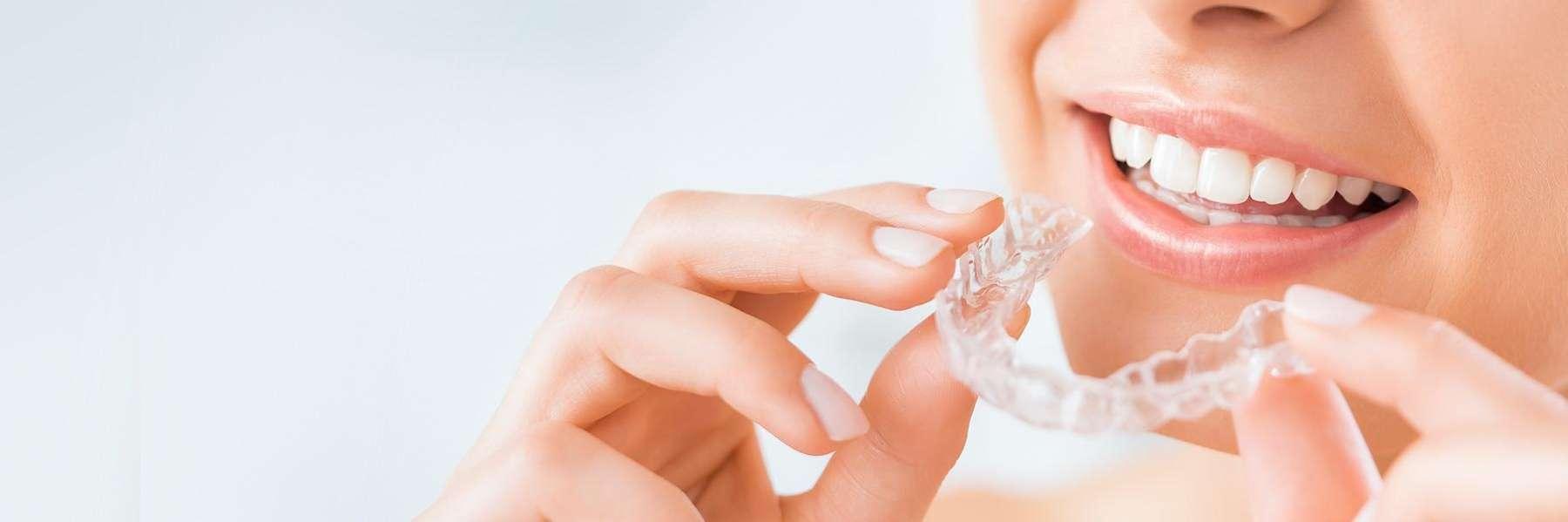 Invisalign® Clear Braces | Dentist